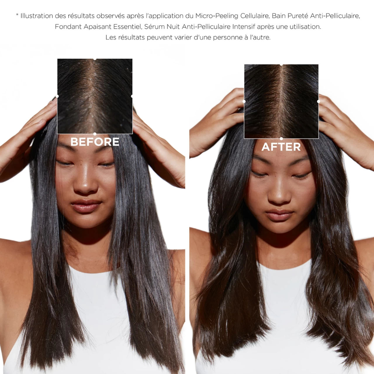 Bain Pureté Anti-Pelliculaire Symbiose Kérastase 250ml 3 Bain Pureté Anti-Pelliculaire Symbiose Kérastase 250ml – Image 3